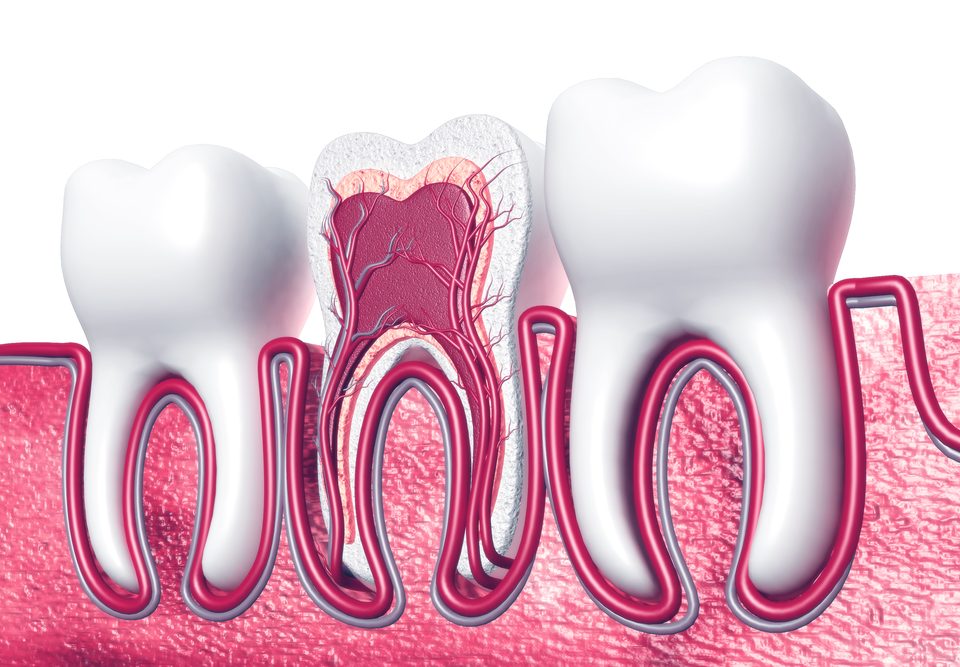 How Root Canal Infection Treated